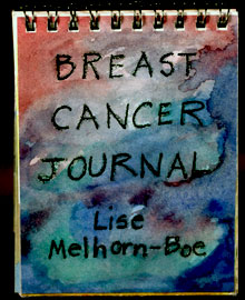 Breast Cancer Journal book